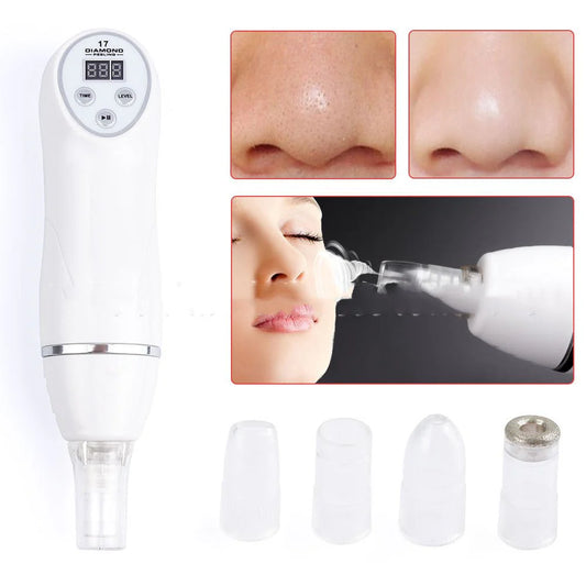 Electric Pore Suction & Acne Removal Device